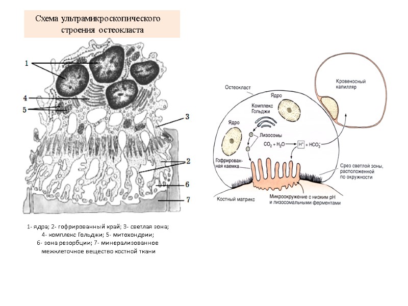 Схема ультрамикроскопического  строения остеокласта  1- ядра; 2- гофрированный край; 3- светлая зона;